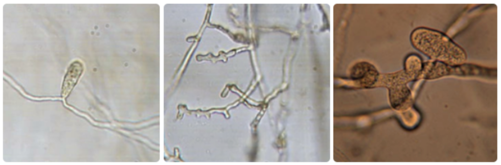 The pathogen called Pythium under a microscope